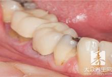 牙齿疏松有缝隙的原因，危害及缓解方法